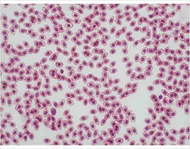 Chicken Blood Smear