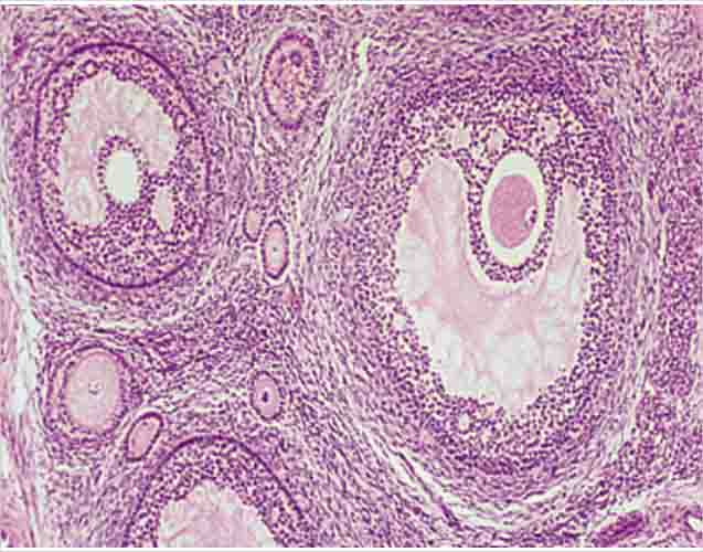 Ovary Slide 