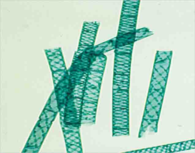 Spirogyra Slide 